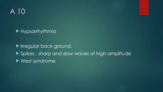 A 10
 Hypsarrhythmia
 Irregular back ground.
 Spikes , sharp and slow waves of high amplitude
 West syndrome
 