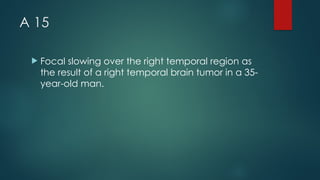 A 15
 Focal slowing over the right temporal region as
the result of a right temporal brain tumor in a 35-
year-old man.
 