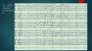 Q 16 elderly
man with a
metabolic
encephalopat
hy.
 