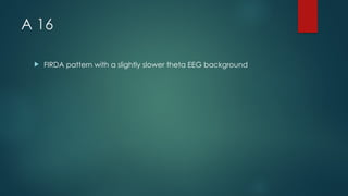 A 16
 FIRDA pattern with a slightly slower theta EEG background
 