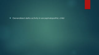  Generalized delta activity in encephalopathic child
 