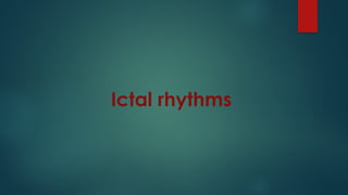 Ictal rhythms
 