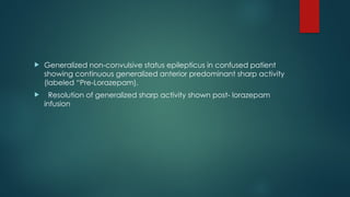  Generalized non-convulsive status epilepticus in confused patient
showing continuous generalized anterior predominant sharp activity
(labeled “Pre-Lorazepam).
 Resolution of generalized sharp activity shown post- lorazepam
infusion
 