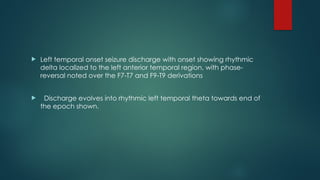  Left temporal onset seizure discharge with onset showing rhythmic
delta localized to the left anterior temporal region, with phase-
reversal noted over the F7-T7 and F9-T9 derivations
 Discharge evolves into rhythmic left temporal theta towards end of
the epoch shown.
 