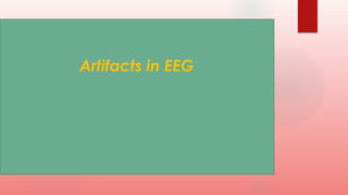 Artifacts in EEG
 