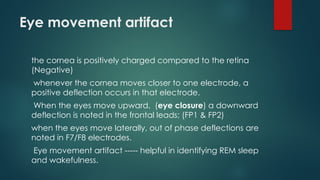 Eye movement artifact
the cornea is positively charged compared to the retina
(Negative)
whenever the cornea moves closer to one electrode, a
positive deflection occurs in that electrode.
When the eyes move upward, (eye closure) a downward
deflection is noted in the frontal leads; (FP1 & FP2)
when the eyes move laterally, out of phase deflections are
noted in F7/F8 electrodes.
Eye movement artifact ----- helpful in identifying REM sleep
and wakefulness.
 