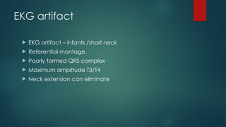 EKG artifact
 EKG artifact – infants /short neck
 Referential montage.
 Poorly formed QRS complex
 Maximum amplitude T3/T4
 Neck extension can eliminate
 
