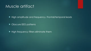 Muscle artifact
 High amplitude and frequency. Frontal/temporal leads
 Obscure EEG patterns
 High frequency filters eliminate them
 