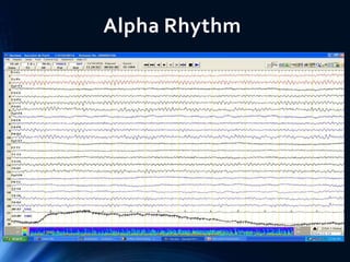 EEG of Children and Sleep | PPTX