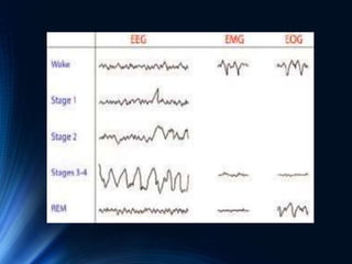 EEG of Children and Sleep | PPTX
