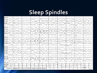 EEG of Children and Sleep | PPTX