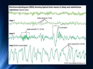 EEG of Children and Sleep | PPTX