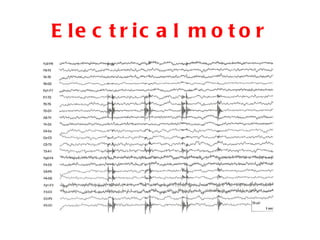Electrical motor 