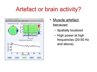 Artefact or brain activity? Muscle artefact , because: Spatially localized  High power at high frequencies (20-50 Hz and above). 