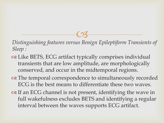 
Distinguishing features versus Benign Epileptiform Transients of
Sleep :
 Like BETS, ECG artifact typically comprises individual
transients that are low amplitude, are morphologically
conserved, and occur in the midtemporal regions.
 The temporal correspondence to simultaneously recorded
ECG is the best means to differentiate these two waves.
 If an ECG channel is not present, identifying the wave in
full wakefulness excludes BETS and identifying a regular
interval between the waves supports ECG artifact.
 