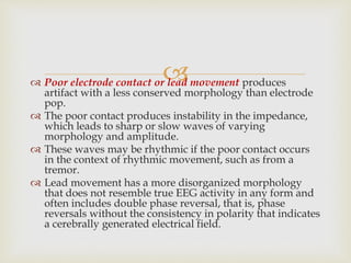  Poor electrode contact or lead movement produces
artifact with a less conserved morphology than electrode
pop.
 The poor contact produces instability in the impedance,
which leads to sharp or slow waves of varying
morphology and amplitude.
 These waves may be rhythmic if the poor contact occurs
in the context of rhythmic movement, such as from a
tremor.
 Lead movement has a more disorganized morphology
that does not resemble true EEG activity in any form and
often includes double phase reversal, that is, phase
reversals without the consistency in polarity that indicates
a cerebrally generated electrical field.
 