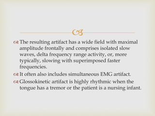 
 The resulting artifact has a wide field with maximal
amplitude frontally and comprises isolated slow
waves, delta frequency range activity, or, more
typically, slowing with superimposed faster
frequencies.
 It often also includes simultaneous EMG artifact.
 Glossokinetic artifact is highly rhythmic when the
tongue has a tremor or the patient is a nursing infant.
 
