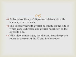  Both ends of the eyes’ dipoles are detectable with
lateral eye movements.
 This is observed with greater positivity on the side to
which gaze is directed and greater negativity on the
opposite side.
 With bipolar montages, positive and negative phase
reversals are seen at the F7 and F8 electrodes.
 