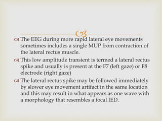  The EEG during more rapid lateral eye movements
sometimes includes a single MUP from contraction of
the lateral rectus muscle.
 This low amplitude transient is termed a lateral rectus
spike and usually is present at the F7 (left gaze) or F8
electrode (right gaze)
 The lateral rectus spike may be followed immediately
by slower eye movement artifact in the same location
and this may result in what appears as one wave with
a morphology that resembles a focal IED.
 