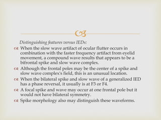 
Distinguishing features versus IEDs:
 When the slow wave artifact of ocular flutter occurs in
combination with the faster frequency artifact from eyelid
movement, a compound wave results that appears to be a
bifrontal spike and slow wave complex.
 Although the frontal poles may be the center of a spike and
slow wave complex's field, this is an unusual location.
 When the bilateral spike and slow wave of a generalized IED
has a phase reversal, it usually is at F3 or F4.
 A focal spike and wave may occur at one frontal pole but it
would not have bilateral symmetry.
 Spike morphology also may distinguish these waveforms.
 