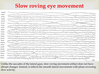 Roving Eye Movements