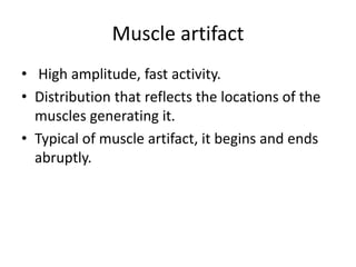 Muscle artifact
• High amplitude, fast activity.
• Distribution that reflects the locations of the
muscles generating it.
• Typical of muscle artifact, it begins and ends
abruptly.
 