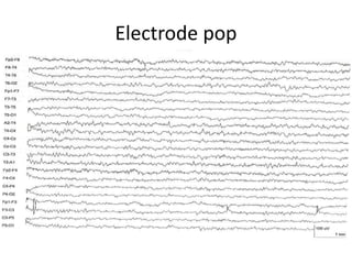 Electrode pop
 