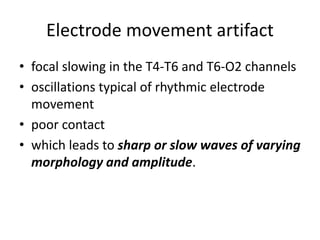 Electrode movement artifact
• focal slowing in the T4-T6 and T6-O2 channels
• oscillations typical of rhythmic electrode
movement
• poor contact
• which leads to sharp or slow waves of varying
morphology and amplitude.
 