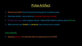  Mechanical artifact from the heart arise through the circulatory pulse
 Electrode artifact - occurs when an electrode rests over a vessel
 Periodic slow wave with a regular interval - follows EKG artifact’s peak by about 200msec
 Most common over frontal and temporal, less common over occipital
How to Identify:
 Applying pressure on electrode alters its appearance on the EEG
Pulse Artifact
 