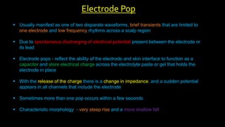  Usually manifest as one of two disparate waveforms, brief transients that are limited to
one electrode and low frequency rhythms across a scalp region
 Due to spontaneous discharging of electrical potential present between the electrode or
its lead
 Electrode pops - reflect the ability of the electrode and skin interface to function as a
capacitor and store electrical charge across the electrolyte paste or gel that holds the
electrode in place
 With the release of the charge there is a change in impedance, and a sudden potential
appears in all channels that include the electrode
 Sometimes more than one pop occurs within a few seconds
 Characteristic morphology - very steep rise and a more shallow fall
Electrode Pop
 