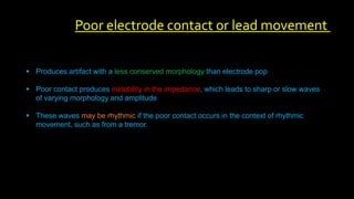  Produces artifact with a less conserved morphology than electrode pop
 Poor contact produces instability in the impedance, which leads to sharp or slow waves
of varying morphology and amplitude
 These waves may be rhythmic if the poor contact occurs in the context of rhythmic
movement, such as from a tremor.
Poor electrode contact or lead movement
 