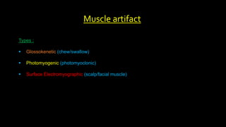 Muscle artifact
Types :
 Glossokenetic (chew/swallow)
 Photomyogenic (photomyoclonic)
 Surface Electromyographic (scalp/facial muscle)
 
