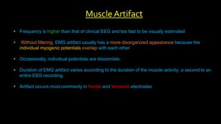  Frequency is higher than that of clinical EEG and too fast to be visually estimated
 Without filtering, EMG artifact usually has a more disorganized appearance because the
individual myogenic potentials overlap with each other
 Occasionally, individual potentials are discernible.
 Duration of EMG artifact varies according to the duration of the muscle activity; a second to an
entire EEG recording.
 Artifact occurs most commonly in frontal and temporal electrodes
Muscle Artifact
 