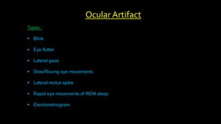 Types :
 Blink
 Eye flutter
 Lateral gaze
 Slow/Roving eye movements
 Lateral rectus spike
 Rapid eye movements of REM sleep
 Electroretinogram
Ocular Artifact
 