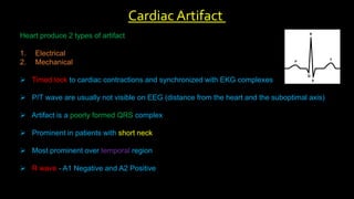 Heart produce 2 types of artifact
1. Electrical
2. Mechanical
 Timed lock to cardiac contractions and synchronized with EKG complexes
 P/T wave are usually not visible on EEG (distance from the heart and the suboptimal axis)
 Artifact is a poorly formed QRS complex
 Prominent in patients with short neck
 Most prominent over temporal region
 R wave - A1 Negative and A2 Positive
Cardiac Artifact
 