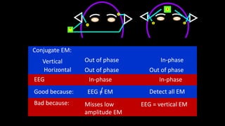 1
2
1
1 1
2
Conjugate EM:
Vertical
Horizontal
Out of phase
EEG
In-phase
Out of phase
In-phase
Detect all EM
Out of phase
In-phase
EEG = EM
EEG = vertical EM
Misses low
amplitude EM
Good because:
Bad because:
 