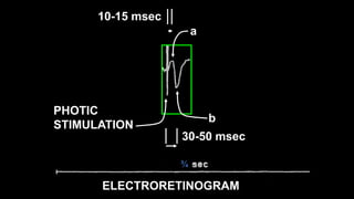 ¾
a
b
PHOTIC
STIMULATION
10-15 msec
30-50 msec
ELECTRORETINOGRAM
 