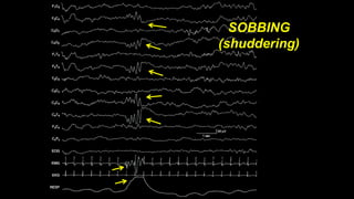 SOBBING
(shuddering)
 