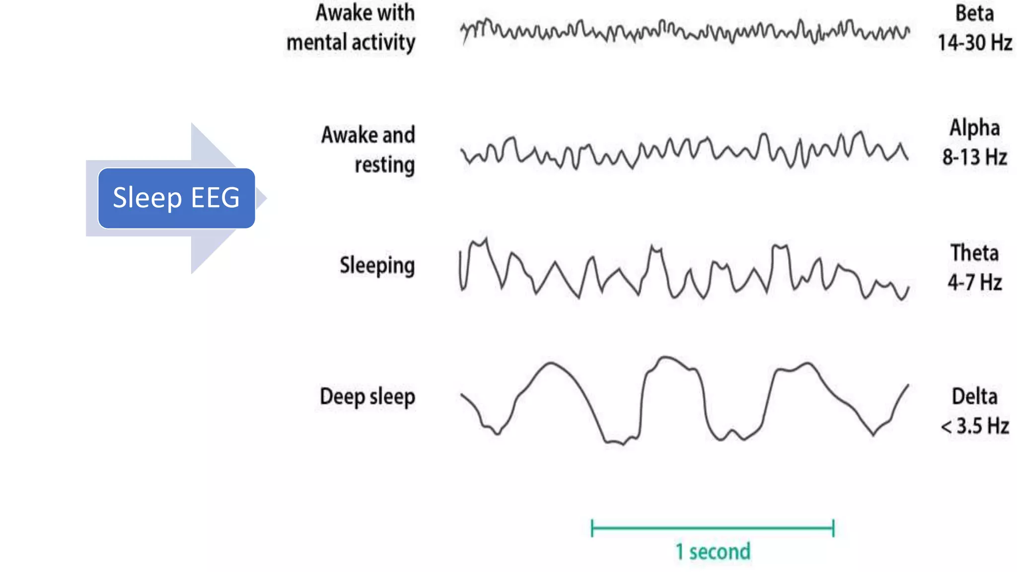 Sleep EEG
 