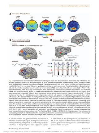 Copyright © 2015, the American Society of Anesthesiologists, Inc. Wolters Kluwer Health, Inc. Unauthorized reproduction of this article is prohibited.
Anesthesiology 2015; 123:937-60 946 Purdon et al.
Electroencephalography for Anesthesiologists
of unconsciousness and profound brain inactivation in
which the electroencephalogram shows periods of electrical
activity alternating with periods of isoelectricity or electri-
cal silence. In the spectrogram, burst suppression appears
as vertical lines in the spectrogram (fig. 6B, minutes 7 to
14). When propofol is administered as an induction bolus,
patients, particularly elderly patients, can enter burst sup-
pression within seconds.68
Fig. 7. Spatiotemporal characterization of electroencephalogram alpha and slow oscillations observed during induction of and
recovery from propofol-induced unconsciousness. (A) In the volunteer subject lying awake with eyes closed, spatially coherent
alpha oscillations are observed over the occipital area. The alpha oscillations shift to the front of the head with loss of conscious-
ness (LOC) where they intensify and become spatially coherent during unconsciousness. The alpha oscillations dissipate anteri-
orly and return to the occipital area during return of consciousness (ROC) where they reintensify and are spatially coherent in the
eyes-closed awake state. (B) During consciousness, there is broadband communication between the thalamus and the frontal
cortex with beta and gamma activity in the electroencephalogram. Modeling studies suggest that during propofol-induced
unconsciousness the spatially coherent alpha oscillations are highly structured rhythms in thalamocortical circuits.57
(C) Slow
oscillations recorded 30 s after bolus induction of general anesthesia with propofol from grid electrodes implanted in a patient
with epilepsy. The slow oscillations at nearby electrodes (red and green dots) are in phase (red and green traces), whereas the
slow oscillation recorded at an electrode 2cm away (blue dot) is out of phase (blue trace) with those at the other two locations.
Neurons spike only (histograms) in a limited time window governed by the phase of the local slow oscillations. These slow oscil-
lations are a marker of intracortical fragmentation with propofol as communication through spiking activity is restricted to local
areas. The spatially coherent alpha oscillations and the disruption of neural spiking activity associated with the slow oscillations
are likely to be two of the mechanisms through which propofol induces unconsciousness. A is adapted, with permission, from
Purdon et al: Electroencephalogram signatures of loss and recovery of consciousness from propofol. Proc Natl Acad Sci U S A
2013; 110:E1142–51; and C is adapted, with permission, from Lewis et al. Rapid fragmentation of neuronal networks at the
onset of propofol-induced unconsciousness. Proc Natl Acad Sci U S A 2012; 109:E3377–86. Adaptations are themselves works
protected by copyright. In order to publish this adaptation, authorization has been obtained both from the owner of the copyright
of the original work and from the owner of copyright of the translation or adaptation.
Downloaded
from
http://pubs.asahq.org/anesthesiology/article-pdf/123/4/937/373943/20151000_0-00034.pdf
by
guest
on
06
May
2023
 