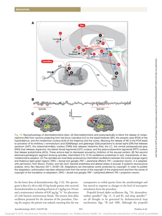 Copyright © 2015, the American Society of Anesthesiologists, Inc. Wolters Kluwer Health, Inc. Unauthorized reproduction of this article is prohibited.
Anesthesiology 2015; 123:937-60 951 Purdon et al.
EDUCATION
for the lower dose of dexmedetomine (fig. 11A). The spectro-
gram is that of a 48-yr-old, 65-kg female patient who received
dexmedetomidine as a loading infusion of 1 μg/kg over 10min
and a maintenance infusion of 0.85 μg kg−1
h−1
for placement
of a left forearm arteriovenous fistula. The intense slow-delta
oscillation persisted for the duration of the procedure. Dur-
ing the surgery, the patient was sedated, meaning that she was
unresponsive to verbal queries from the anesthesiologist and
but moved in response to changes in the level of nociceptive
stimulation from the procedure.
Propofol frontal alpha oscillations (fig. 7A), dexmedeto-
midine spindles45
(fig. 11, A and B), and sleep spindles117
are all thought to be generated by thalamocortical loop
mechanisms (figs. 7B and 10B). Although the propofol
Fig. 10. Neurophysiology of dexmedetomidine (dex). (A) Dexmedetomidine acts presynaptically to block the release of norepi-
nephrine (NE) from neurons projecting from the locus coeruleus (LC) to the basal forebrain (BF), the preoptic area (POA) of the
­
hypothalamus, and the intralaminar nucleus (ILN) of the thalamus and the cortex. Blocking the release of NE in the POA leads
to activation of its inhibitory γ-aminobutyric acid (GABA)ergic and galanergic (Gal) projections to dorsal raphe (DR) that releases
serotonin (5HT), the tuberomammillary nucleus (TMN) that releases histamine (His), the LC, the ventral periaqueductal gray
(PAG) that releases dopamine, the lateral dorsal tegmental (LDT) nucleus, and the pedunculopontine tegmental (PPT) nucleus
that release acetylcholine (ACh). These actions lead to decreased arousal by inhibition of the arousal centers. (B) Ten-second
electroencephalogram segment showing spindles, intermittent 9 to 15 Hz oscillations (underlined in red), characteristic of dex-
medetomidine sedation. (C) The spindles are most likely produced by intermittent oscillations between the cortex (orange region)
and thalamus (light green region). DRG = dorsal root ganglia; PAF = peripheral afferent; PN = projection neuron. A is adapted,
with permission, from Brown, Purdon, and Van Dort: General anesthesia and altered states of arousal: A systems neuroscience
analysis. Annu Rev Neurosci 2011; 34:601–28. Adaptations are themselves works protected by copyright. In order to publish
this adaptation, authorization has been obtained both from the owner of the copyright of the original work and from the owner of
copyright of the translation or adaptation. DRG = dorsal root ganglia; PAF = peripheral afferent; PN = projection neuron.
Downloaded
from
http://pubs.asahq.org/anesthesiology/article-pdf/123/4/937/373943/20151000_0-00034.pdf
by
guest
on
06
May
2023
 
