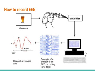 End Program Eeg EEG course.pptx