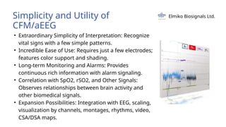 Simplicity and Utility of
CFM/aEEG
• Extraordinary Simplicity of Interpretation: Recognize
vital signs with a few simple patterns.
• Incredible Ease of Use: Requires just a few electrodes;
features color support and shading.
• Long-term Monitoring and Alarms: Provides
continuous rich information with alarm signaling.
• Correlation with SpO2, rSO2, and Other Signals:
Observes relationships between brain activity and
other biomedical signals.
• Expansion Possibilities: Integration with EEG, scaling,
visualization by channels, montages, rhythms, video,
CSA/DSA maps.
Elmiko Biosignals Ltd.
 