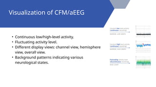 • Continuous low/high-level activity.
• Fluctuating activity level.
• Different display views: channel view, hemisphere
view, overall view.
• Background patterns indicating various
neurological states.
Visualization of CFM/aEEG
 