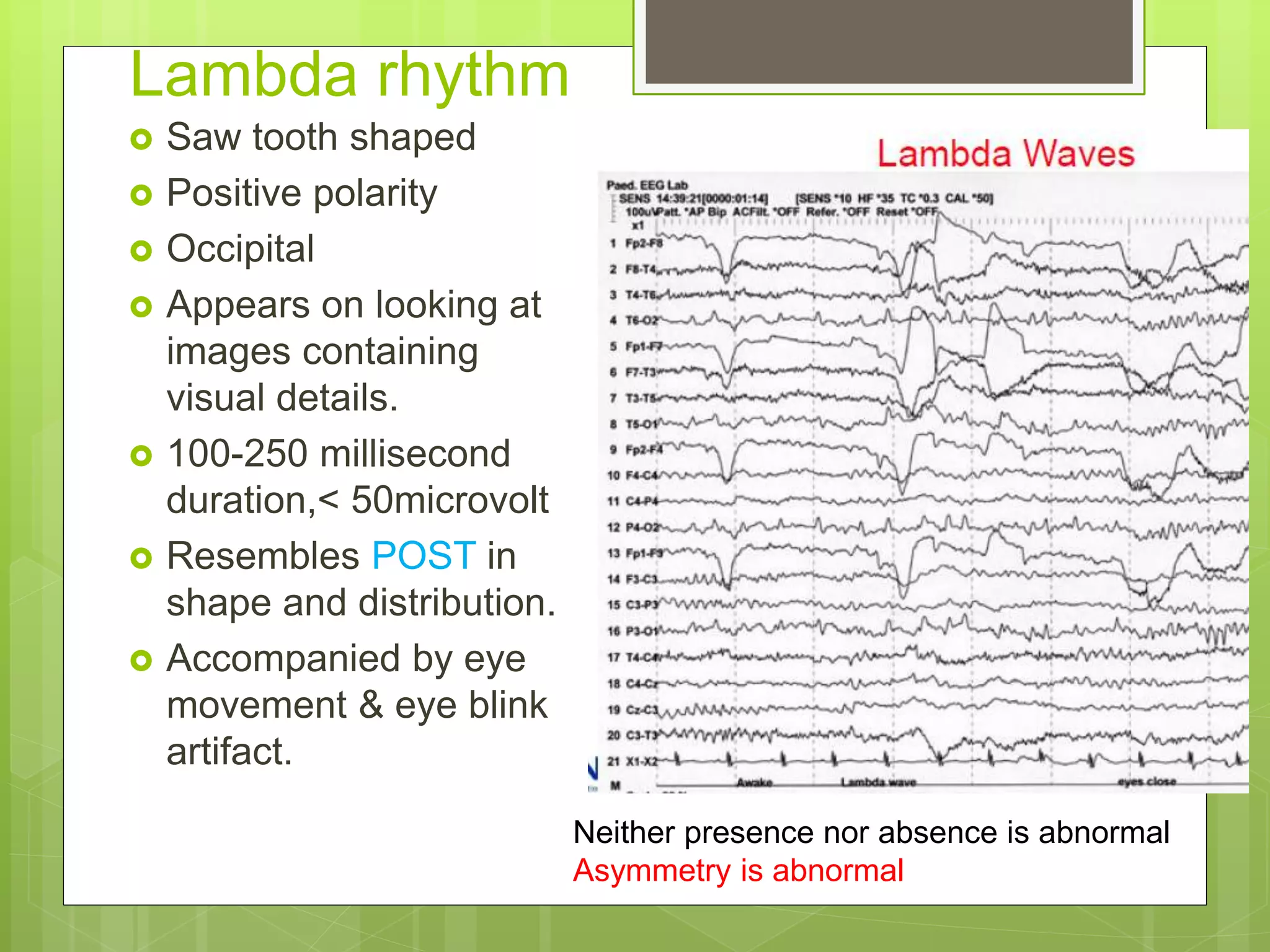 Lambda rhythm
 Saw tooth shaped
 Positive polarity
 Occipital
 Appears on looking at
images containing
visual details.
 100-250 millisecond
duration,< 50microvolt
 Resembles POST in
shape and distribution.
 Accompanied by eye
movement & eye blink
artifact.
Neither presence nor absence is abnormal
Asymmetry is abnormal
 