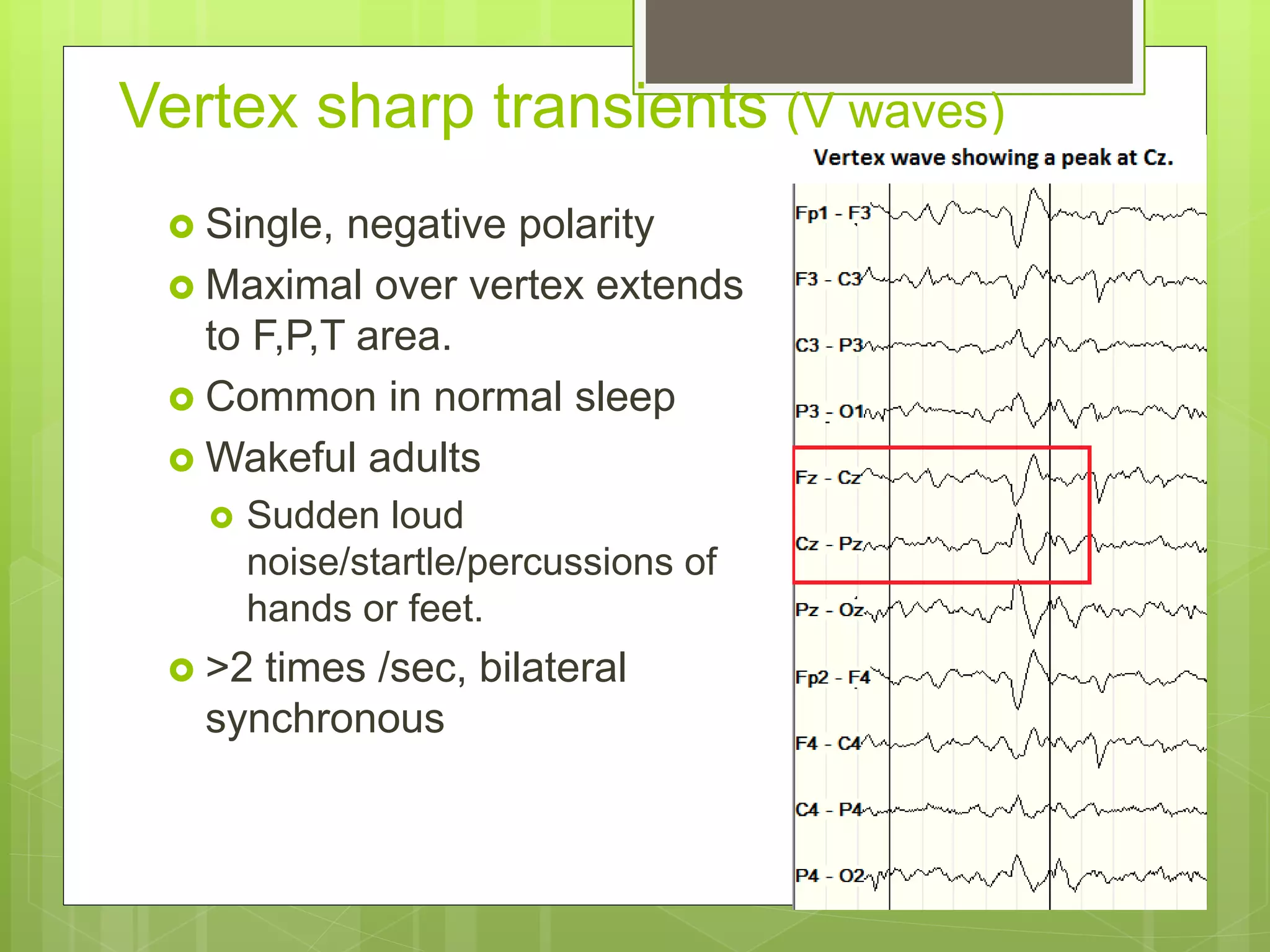 Vertex sharp transients (V waves)
 Single, negative polarity
 Maximal over vertex extends
to F,P,T area.
 Common in normal sleep
 Wakeful adults
 Sudden loud
noise/startle/percussions of
hands or feet.
 >2 times /sec, bilateral
synchronous
 