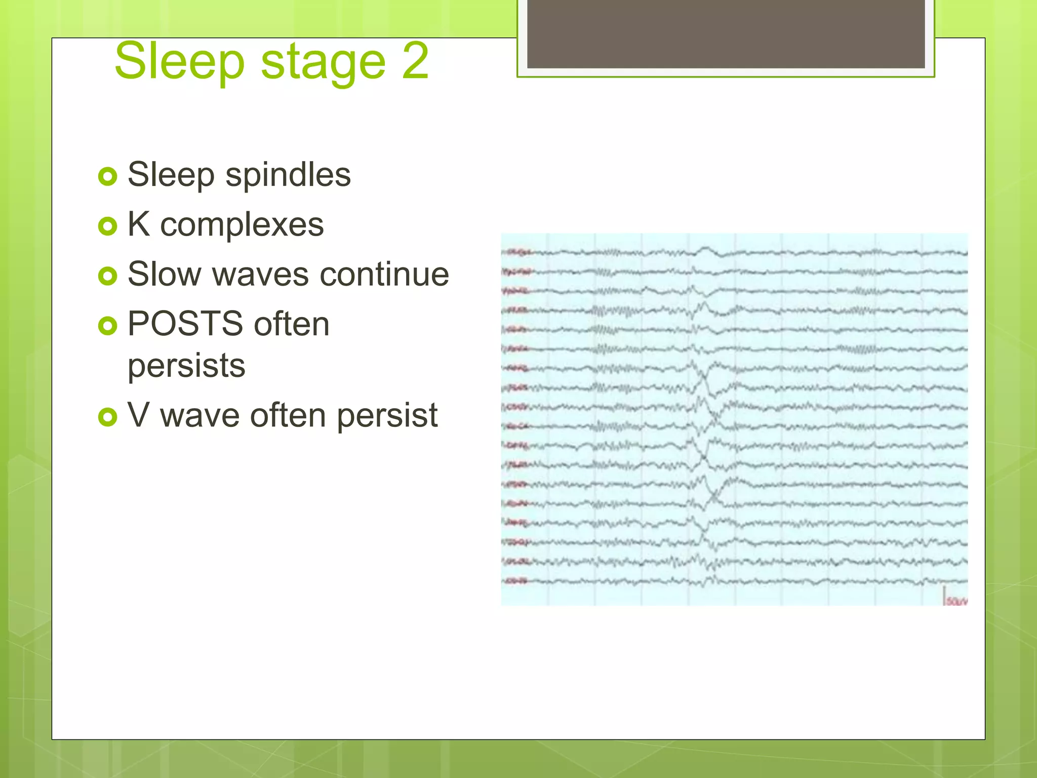 Sleep stage 2
 Sleep spindles
 K complexes
 Slow waves continue
 POSTS often
persists
 V wave often persist
 