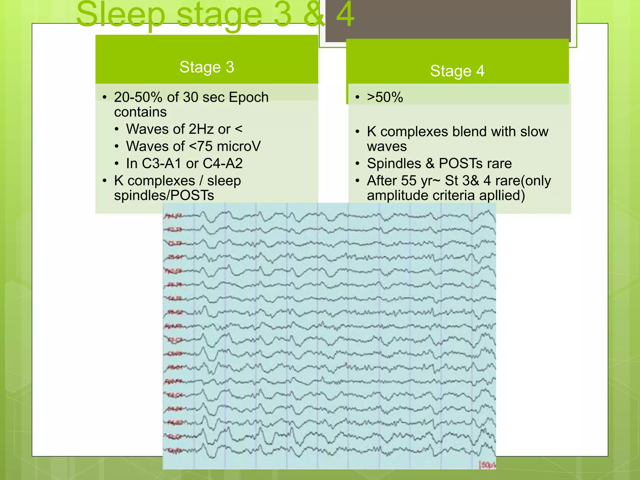 Sleep stage 3 & 4
Stage 3
• 20-50% of 30 sec Epoch
contains
• Waves of 2Hz or <
• Waves of <75 microV
• In C3-A1 or C4-A2
• K complexes / sleep
spindles/POSTs
Stage 4
• >50%
• K complexes blend with slow
waves
• Spindles & POSTs rare
• After 55 yr~ St 3& 4 rare(only
amplitude criteria apllied)
 