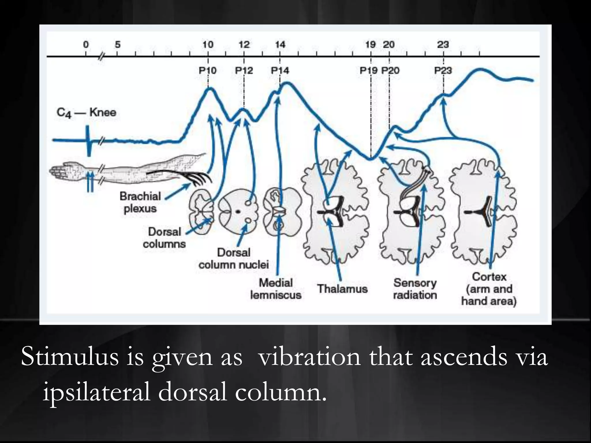 Stimulus is given as vibration that ascends via
ipsilateral dorsal column.
 