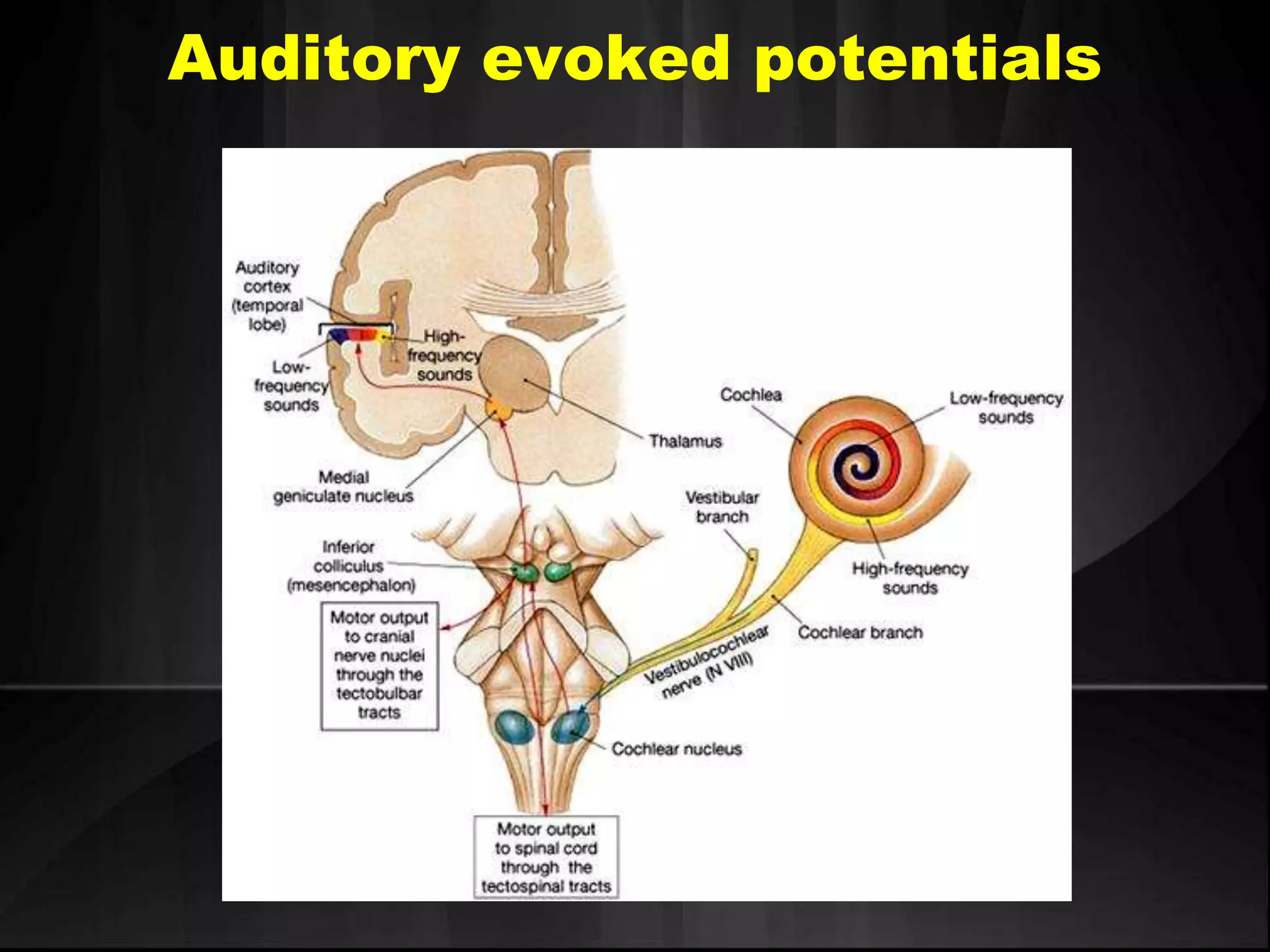 Auditory evoked potentials
 